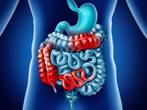 What Can You Do to Protect Yourself From Colorectal Cancer?